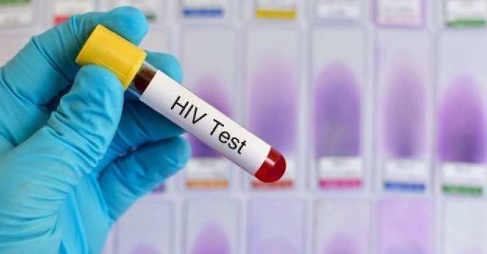 Test HIV per i minori senza consenso obbligatorio dei genitori